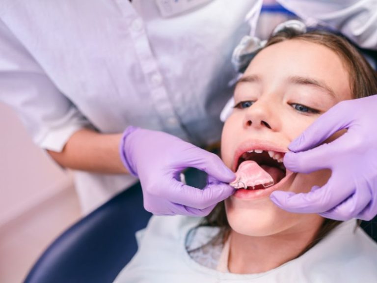ortodoncista prueba aparato de ortodoncia interceptiva a paciente pediátrico