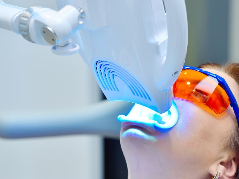 Blanqueamiento Dental en Pacientes Sensibles